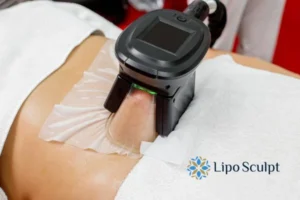 Cryolipolysis Helping You Getting that Perfect Summer Body 3 Cryolipolysis Flitwick can give you the best summer body - contact us today!